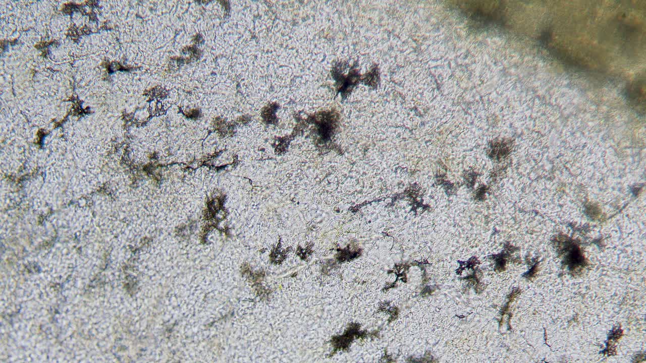 sangre movimiento de eritrocitos en vasos sanguíneos capilares pigmento