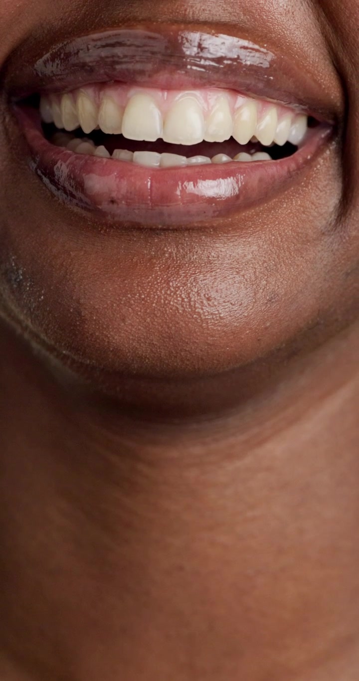 Close-up of a Young Woman Smiling with Glossy Lips