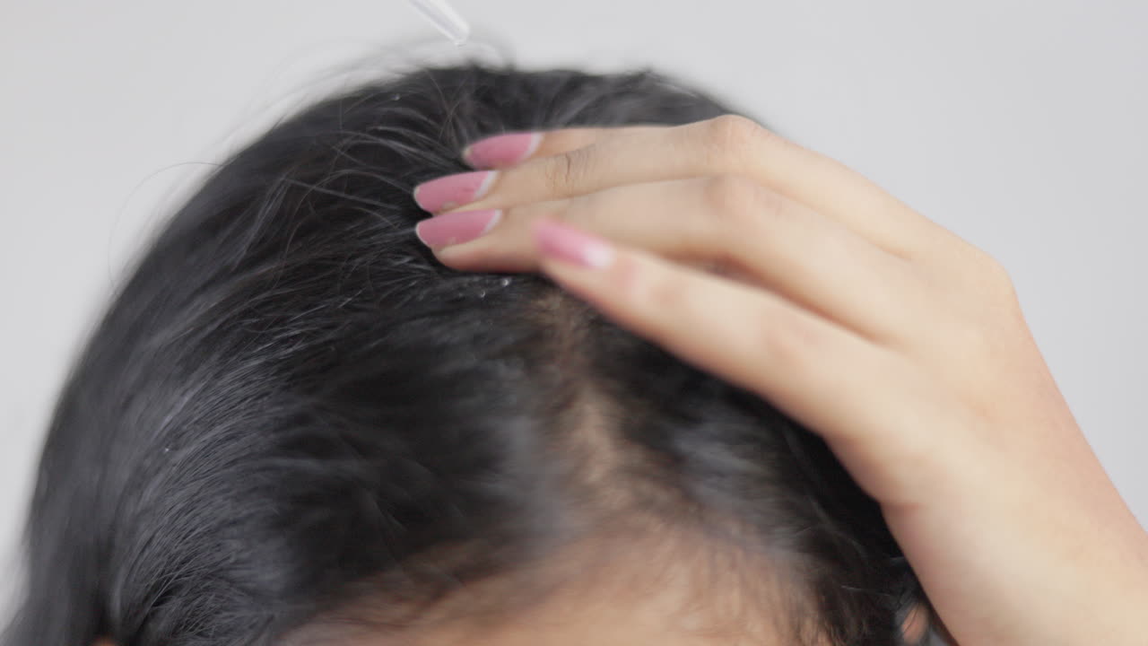 Close up shot of an unrecognisable woman with a dropper applying hair oil on her scalp and massaging to stimulate hair follicle.