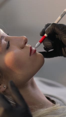 lip enhancement procedure