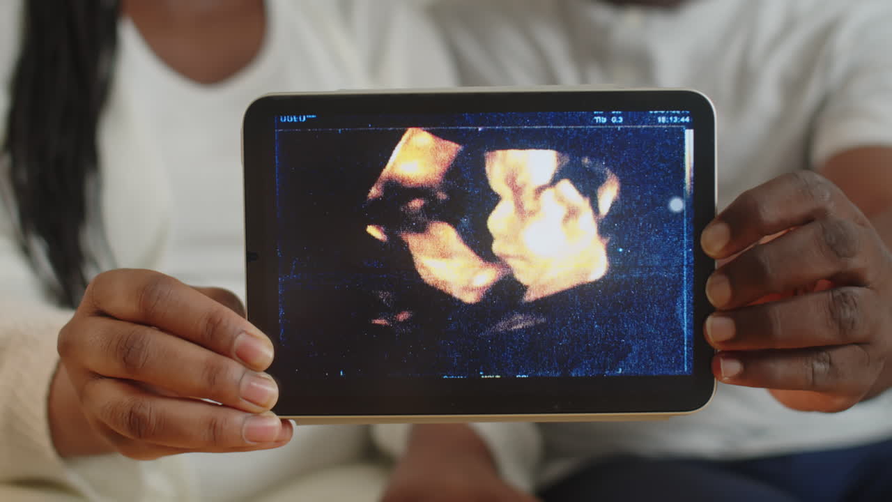 Coppia che tiene in mano un tablet che mostra un'ecografia del loro bambino