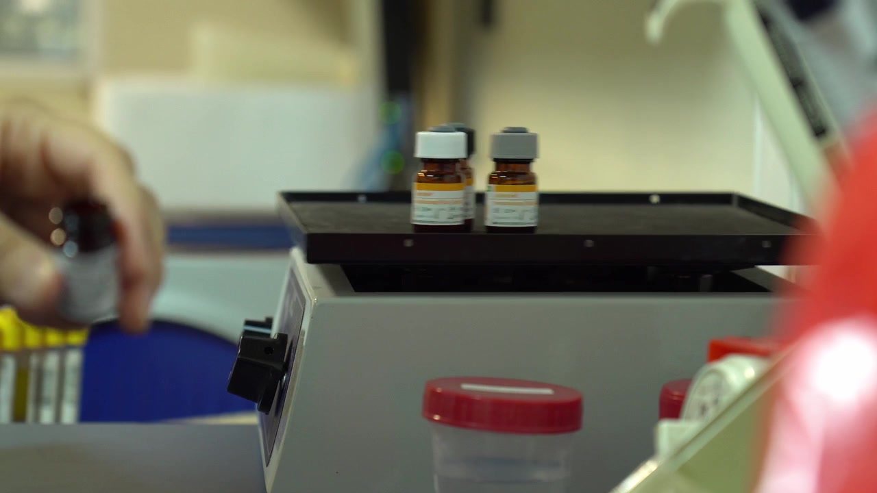 Two vials sit on a lab tray while a hand holds another sample in a clinical testing environment