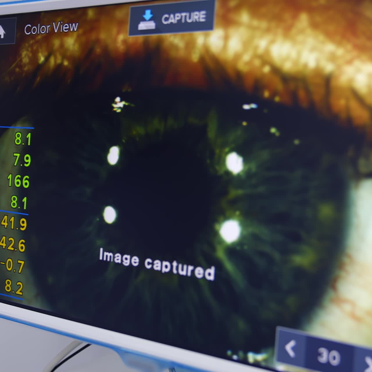Patient's eye on ophthalmologist's monitor. Eye examination test on a professional medical equipment screen. Close-up