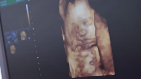 human embryo in color on the screen during sonography. ultrasound of pregnant woman. scientific analysis. tiny baby in mother's belly. close-up.