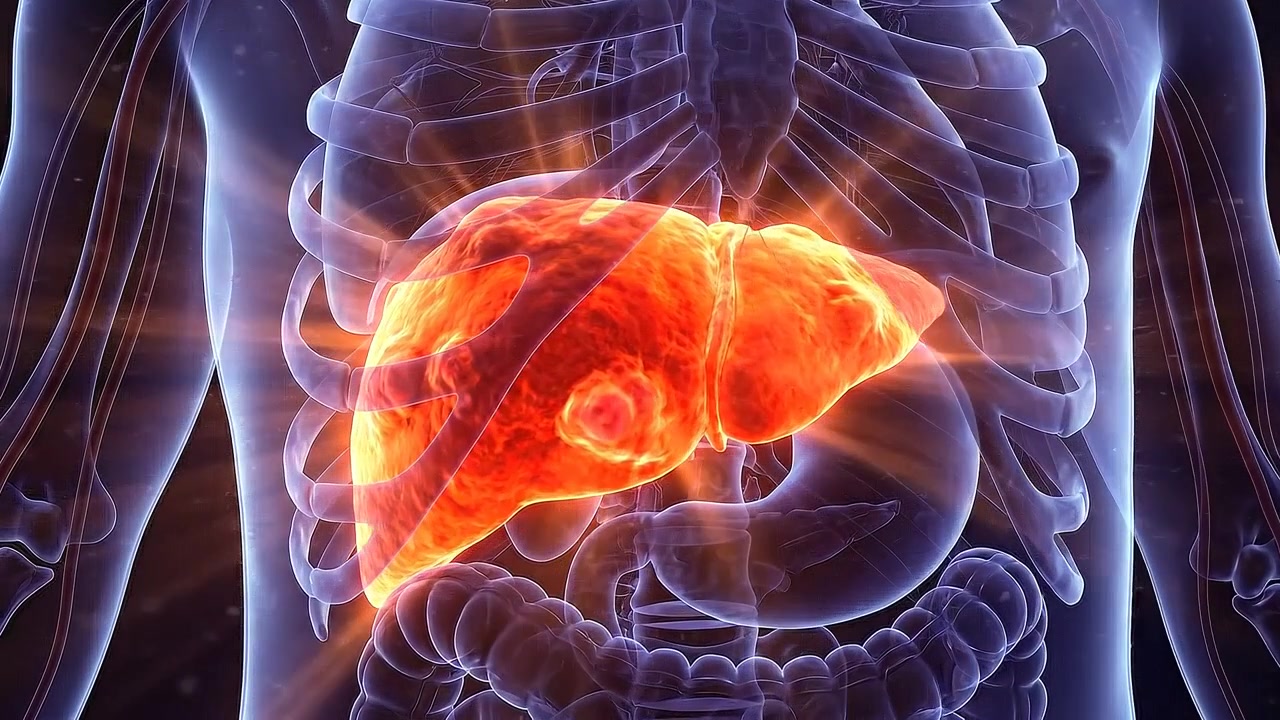 Animazione medica 3D del fegato umano con crescita tumorale