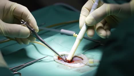 two surgeons work meticulously to complete a surgical procedure in a hospital operating room. their focused efforts highlight the complexity and skill needed in medicine.
