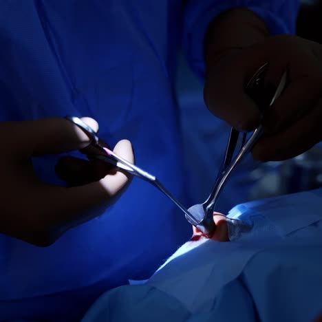hands of the surgeon close-up of the operating patient. modern equipment in operating room