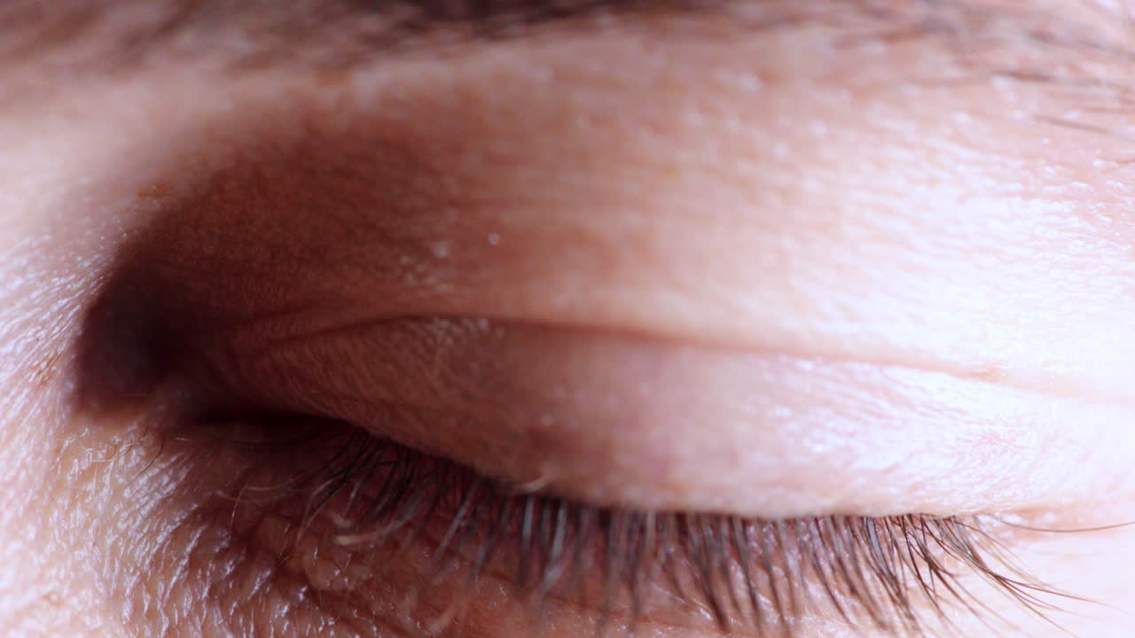 소크, 놀라움과 와우 눈과  ⁇ 과 비전