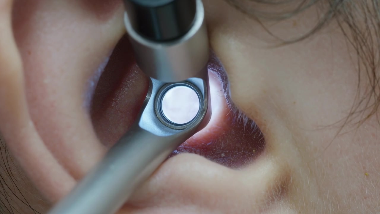 Un otoscopio si avvicina all'orecchio del paziente, il medico inserisce lo speculum nel condotto in clinica per l'ispezione.