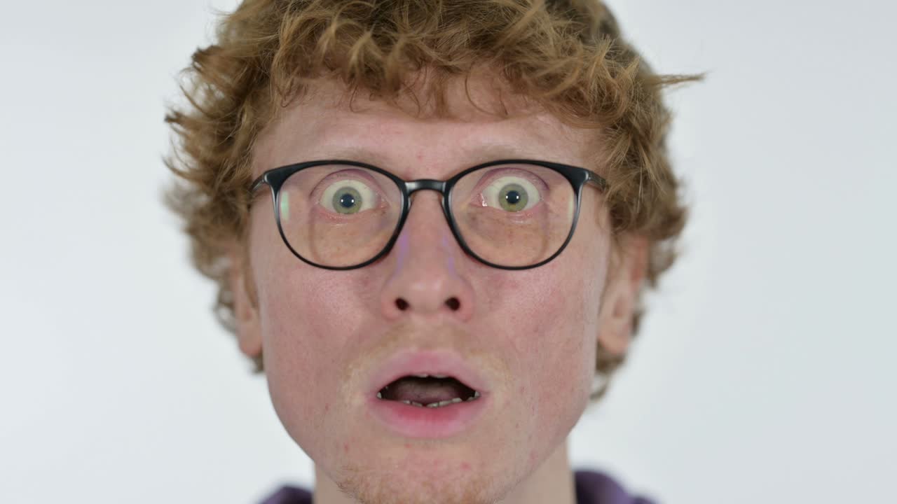 cerca de la cara de un joven pelirrojo con conmoción