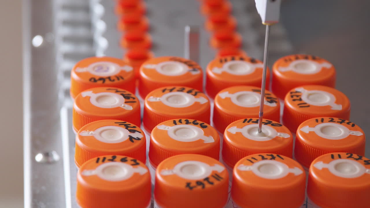 의학 실험실에서 암 환자의 암 세포 탐지 자동화 과정의 클로즈업