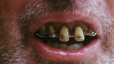 macro shot of disgusting mouth with ugly teeth and wet lips talking to the camera