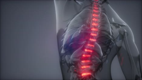 dolor de espalda en los huesos de la espalda
