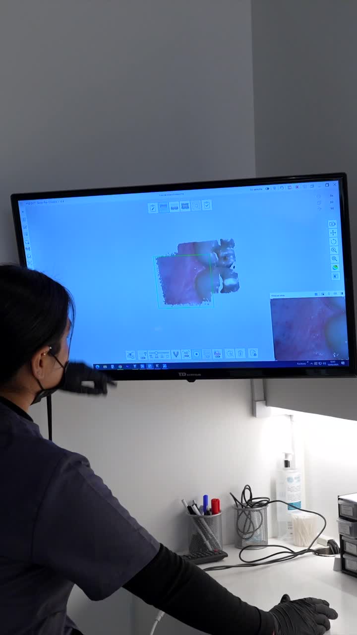 Dental Scan Technology in Use