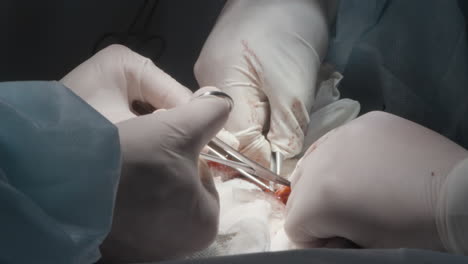 surgical procedure