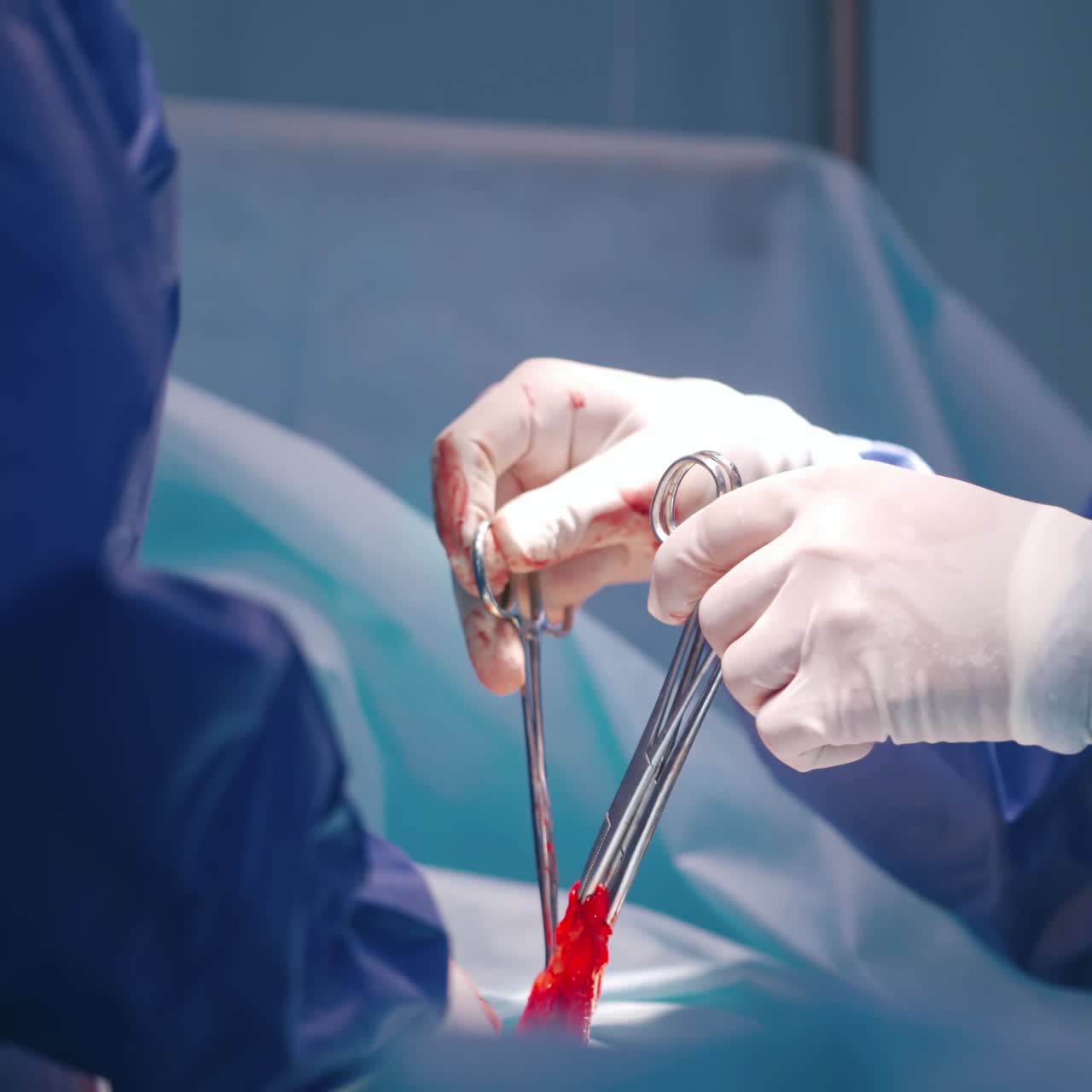 Close up of surgery team operating