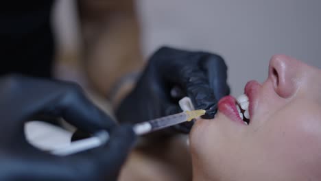 lip filler injection procedure