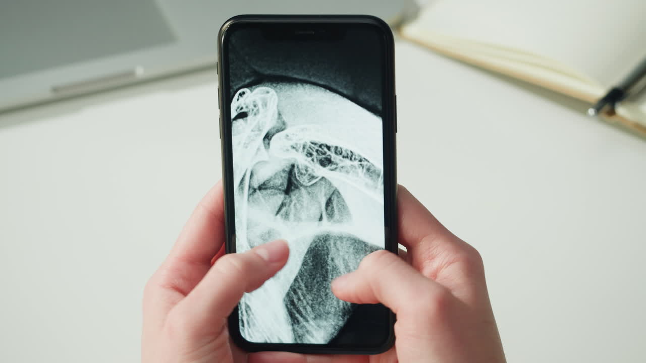 Medical professional viewing X-ray on a smartphone