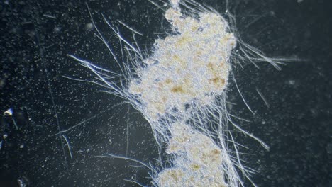 Cyanobacteria-algae-movement-in-light-under-microscope-dark-field-view