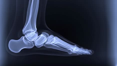 an x-ray displays the intricate bones and joints of a human foot, highlighting the structure and alignment. this can assist in diagnosing injuries or conditions affecting mobility.