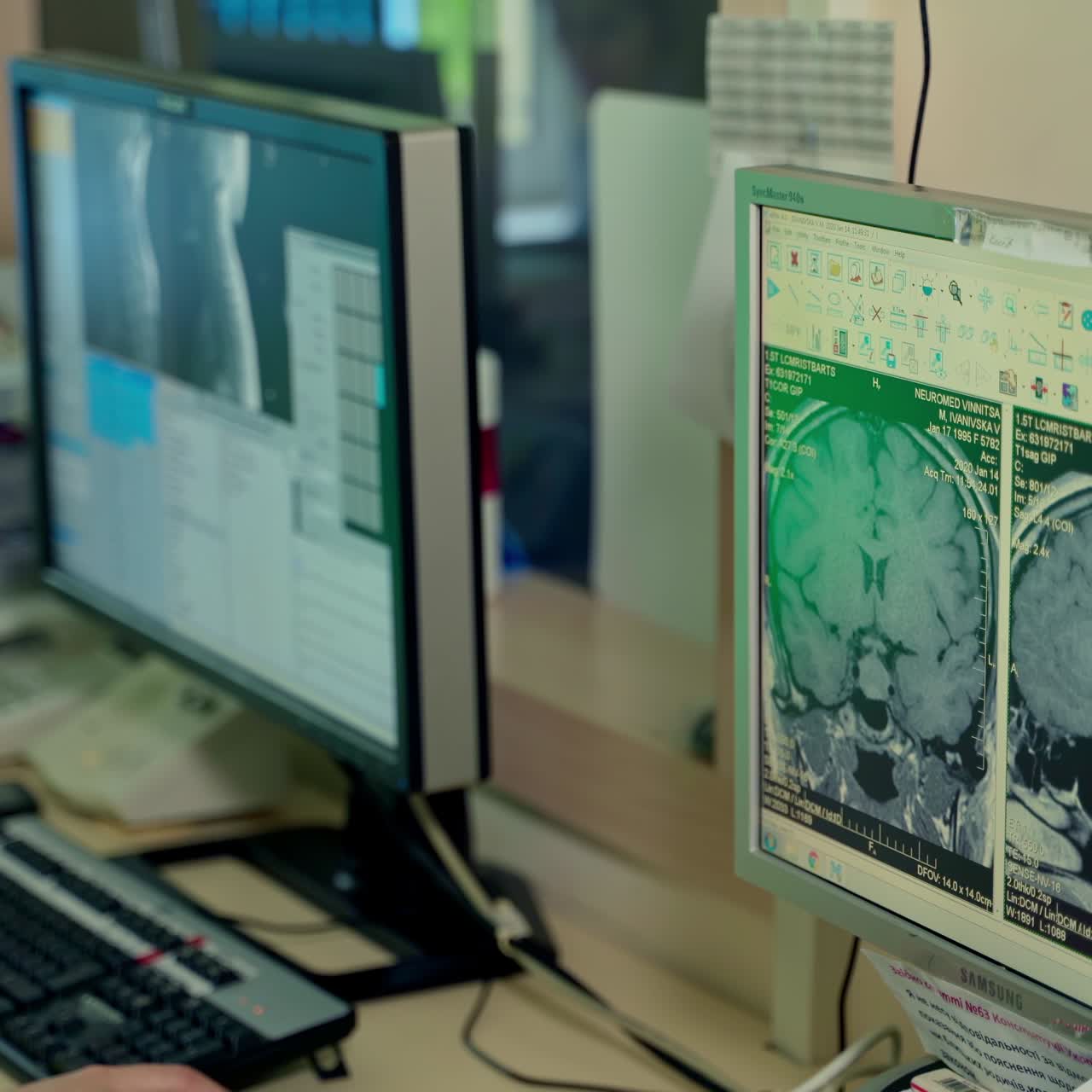 X-ray scanner on computer