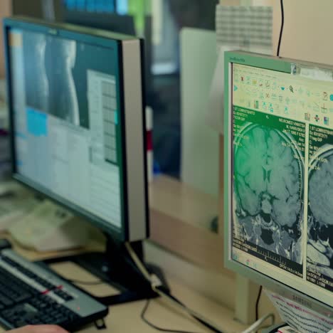 x-ray scanner on computer
