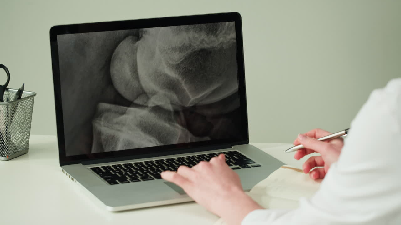 Doctor reviewing X-ray on laptop