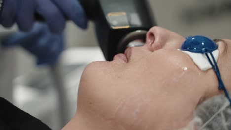 Close-up-of-a-laser-device-being-used-on-a-woman's-face-during-a-skincare-treatment