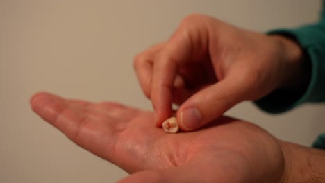 mano del paciente sosteniendo dos dientes de sabiduría recién extraídos
