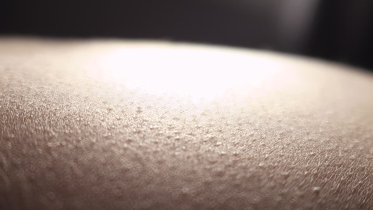 Close-up of Human Skin with Goosebumps
