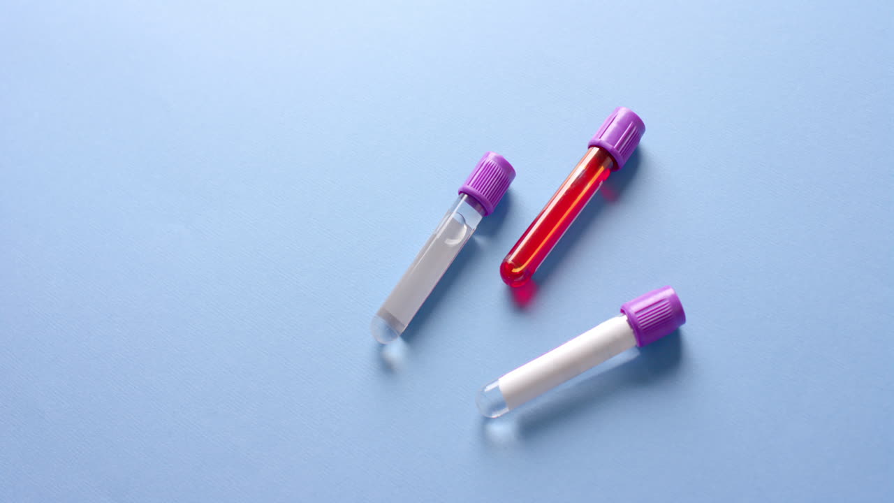 primo piano di campioni di sangue su sfondo blu con spazio di copia, slow motion