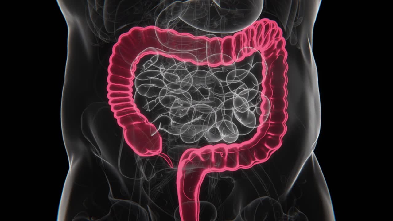 Radiografia della colite ulcerosa in video HD | Radiografia della colite ulcerosa in video HD
