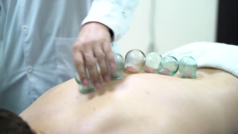 cupping therapy session