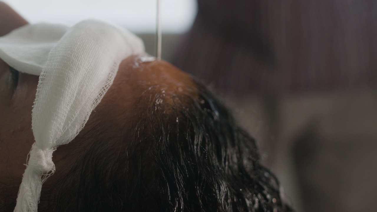 Scalp and Hair Treatment