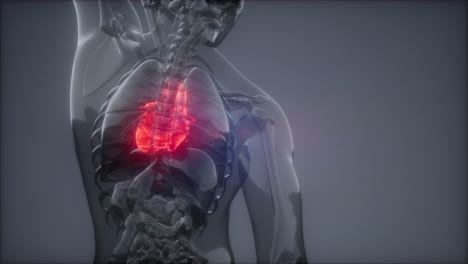examen de radiología del corazón humano