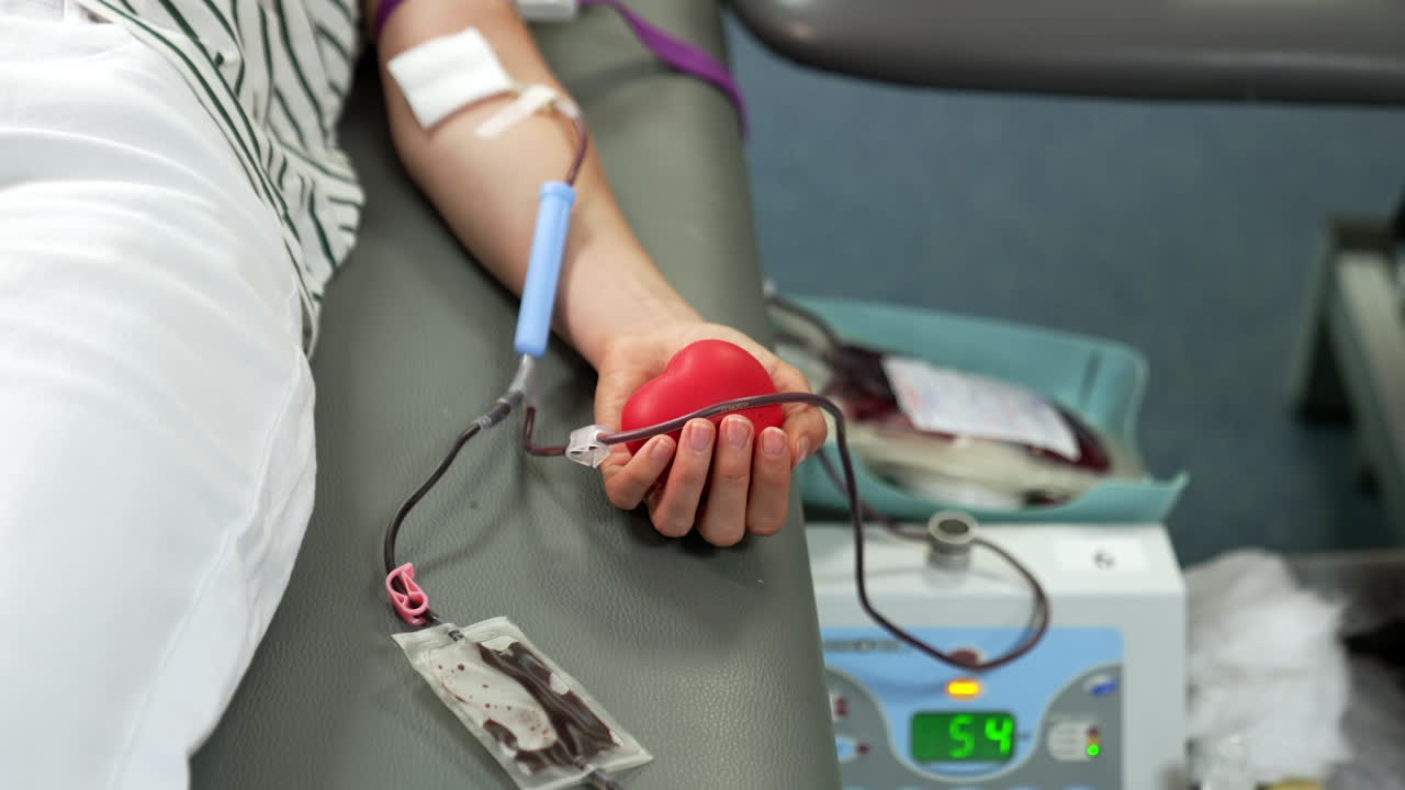 A plastic bag half-filled with blood attached to the catheter and an arm of a woman. Blood donation concept. Close up.
