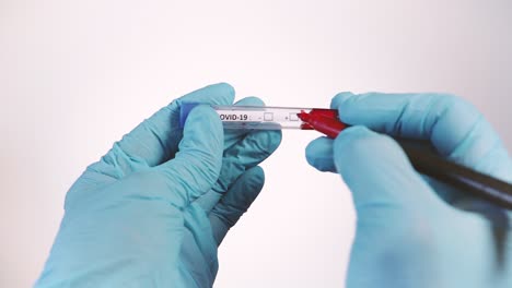 covid-19 positive result on blood sample in test tube