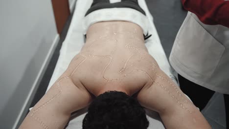 mapeo de gel por ultrasonido en la espalda del hombre para la depilación láser