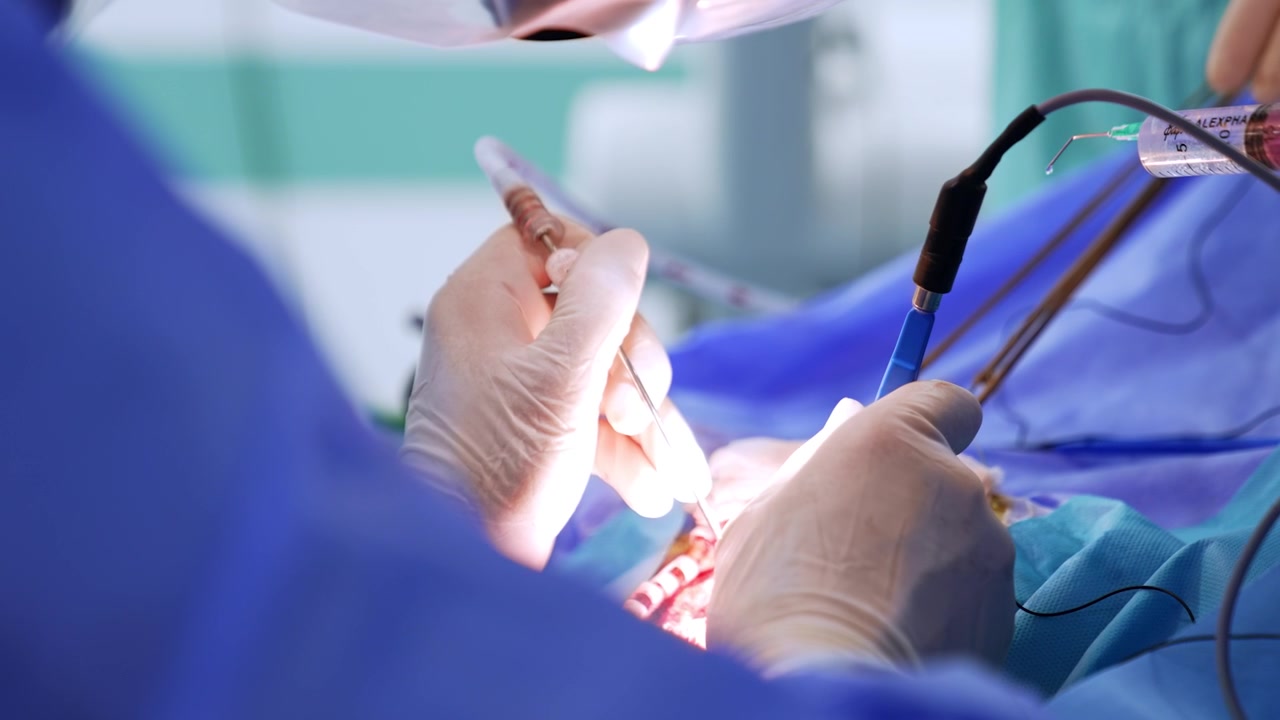 Mano de médico con guantes de látex blancos sostiene dos instrumentos médicos. Asistente rocía líquido de una jeringa. Primer plano