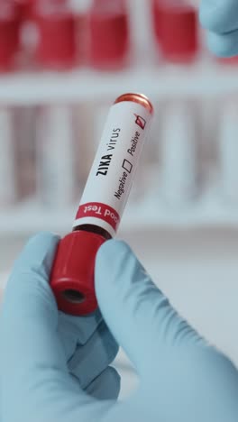 healthcare professional analyzing zika virus blood test results in clinic