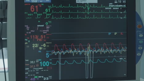 monitoring system in surgical procedure. state-of-the-art monitoring system tracks patient vital signs throughout coronary artery bypass surgery