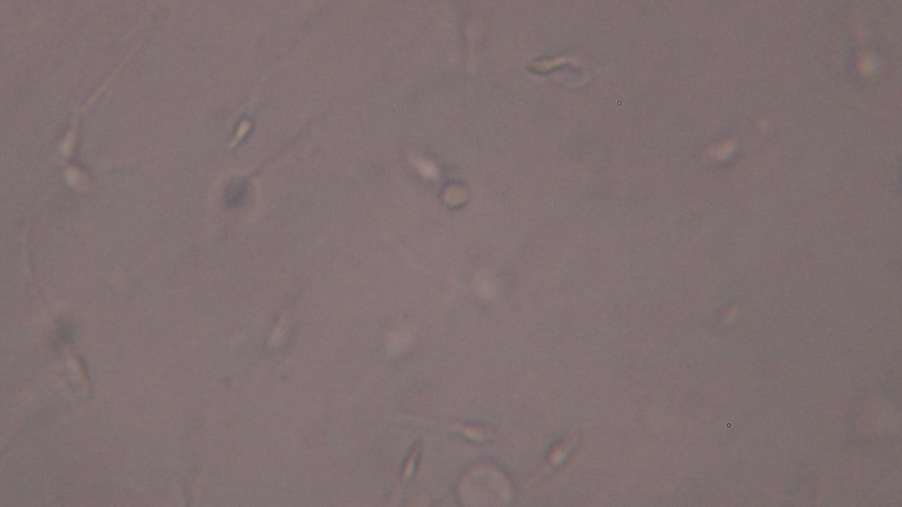 Microscopic view of moving human sperm cells with visible heads and flagella against a light background, commonly used in fertility and reproductive studies