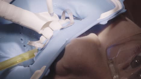 dental procedure in progress with tools and retractors during patient treatment