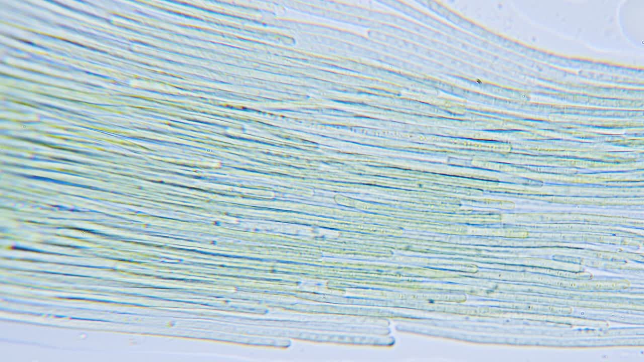현미경으로 시아노박테리아와 녹조류의 움직임