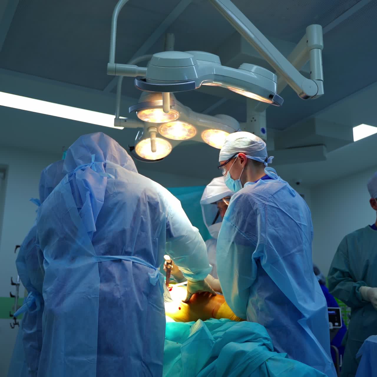 Operating theater. Team of doctors doing a surgery to a patient lying on operating table. Group of surgeons in medical uniform in operating room.