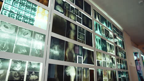 interior detail of the medical museum. anatomical museum with collection of human anatomy