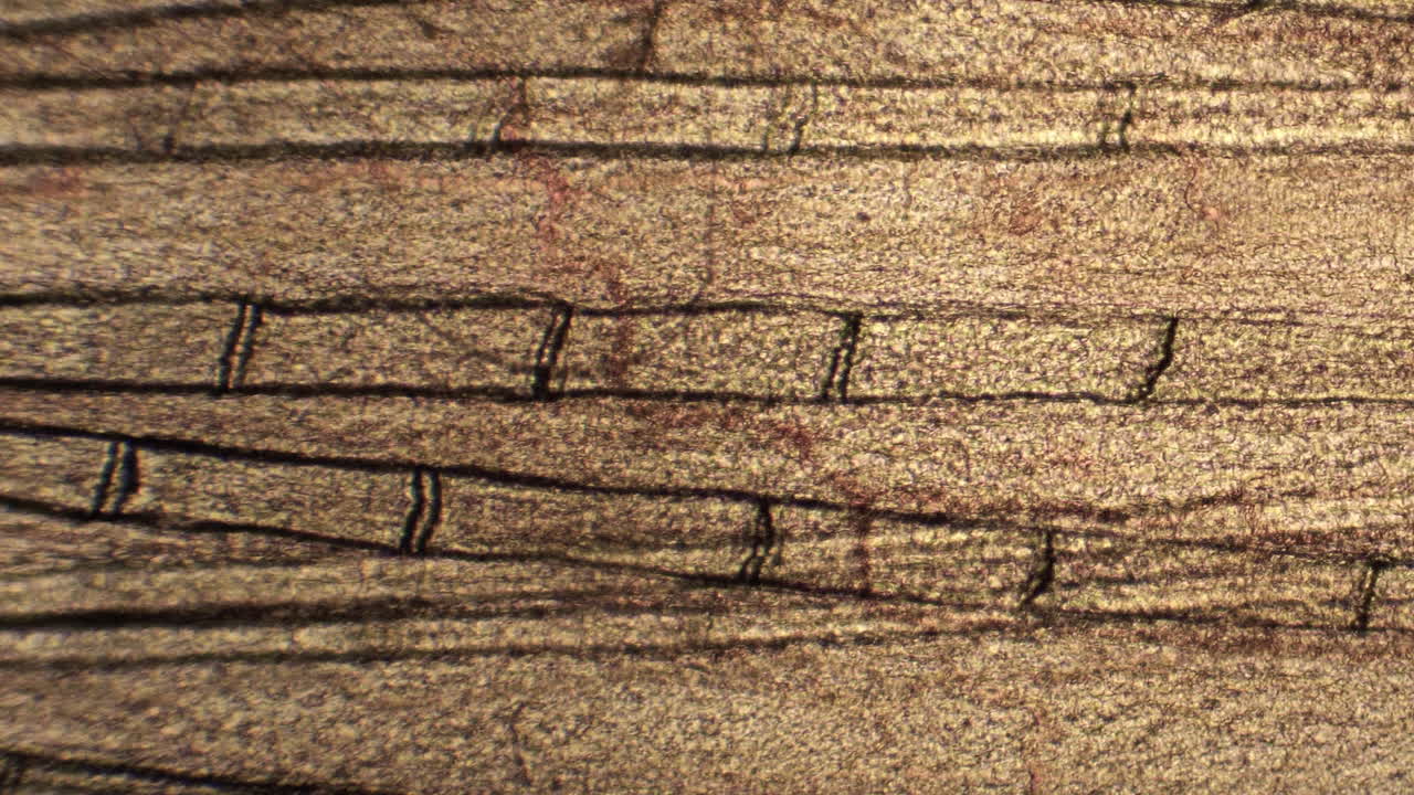 미세한 혈관과 모세혈관은 혈액 세포를 운반합니다.