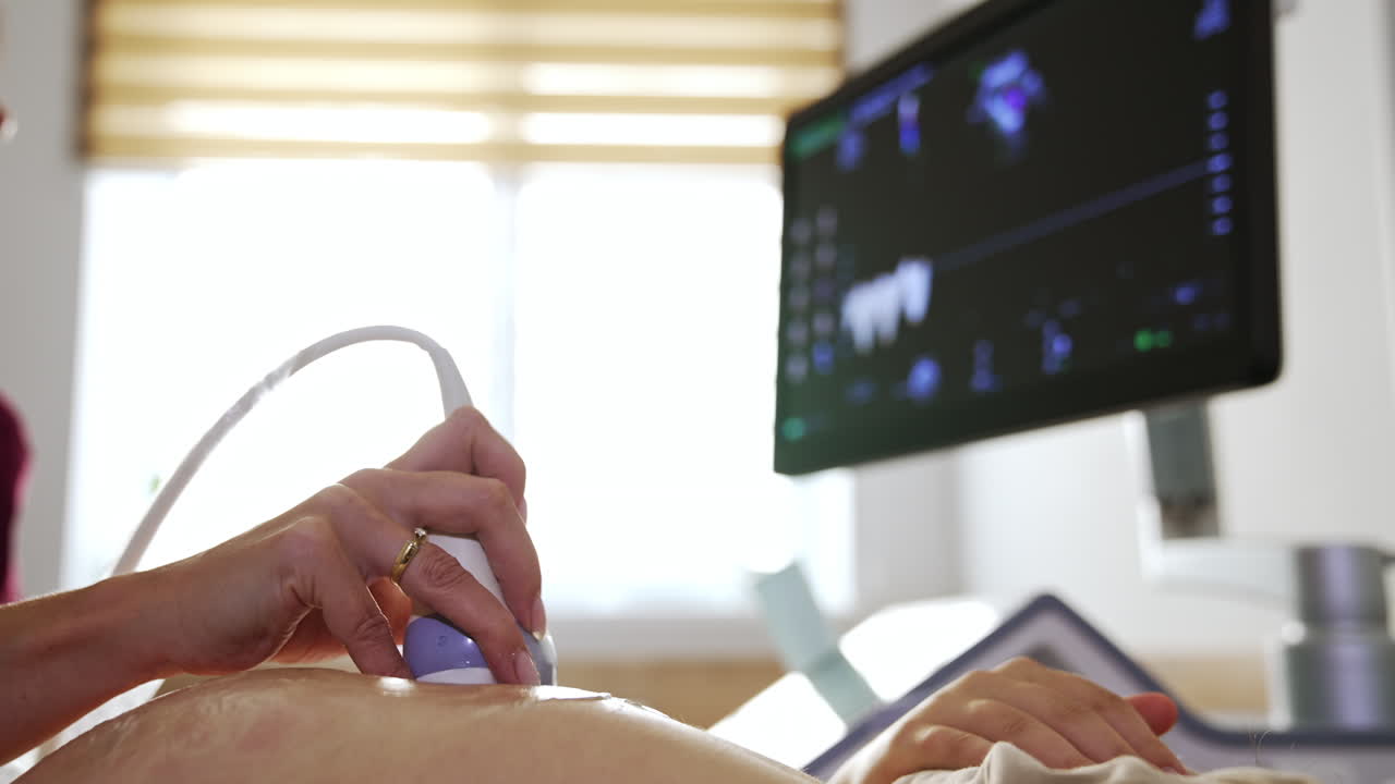 ecografía de una mujer embarazada