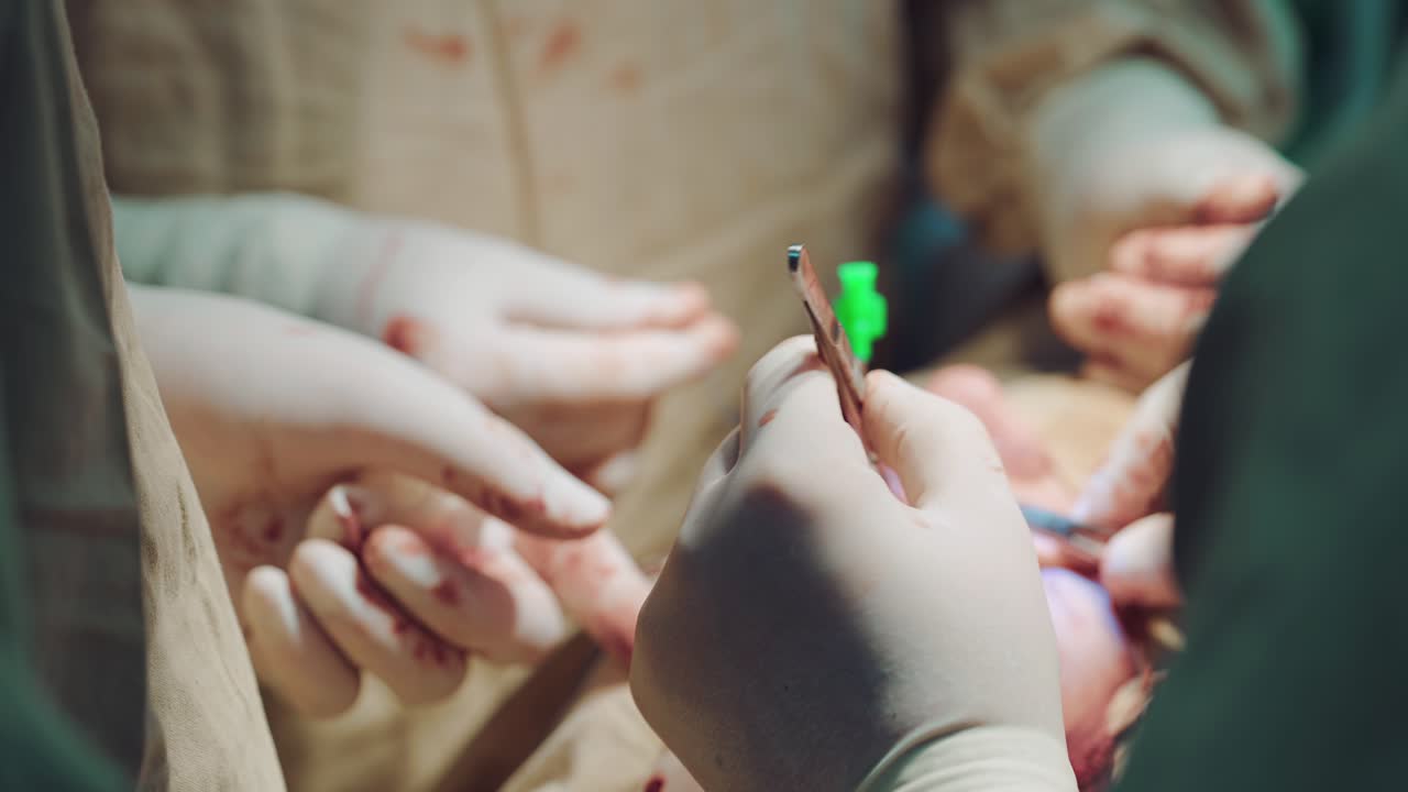 The surgeon is holding medical tweezers in his hand and working on the patient's wound in the hospital. Close-up. Blurred background.