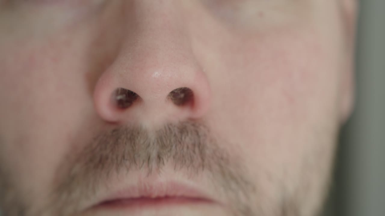 Primo piano di un uomo che arriccia e si tocca il naso a causa di secchezza e prurito. Concetto di irritazione nasale, allergia, sintomi influenzali e disagio personale